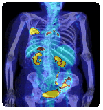 What is a CAT scan with contrast?